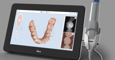 DentiPro Unveiled Revolutionary AI-Powered Dental Scanner